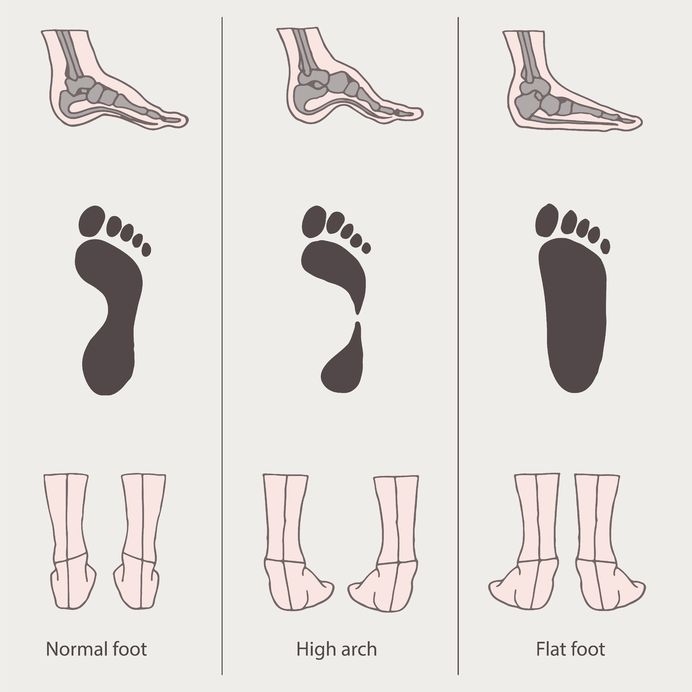 Common Surgical Procedures for Flat 